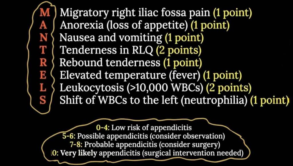 Alvarado score appendicitis scoring system