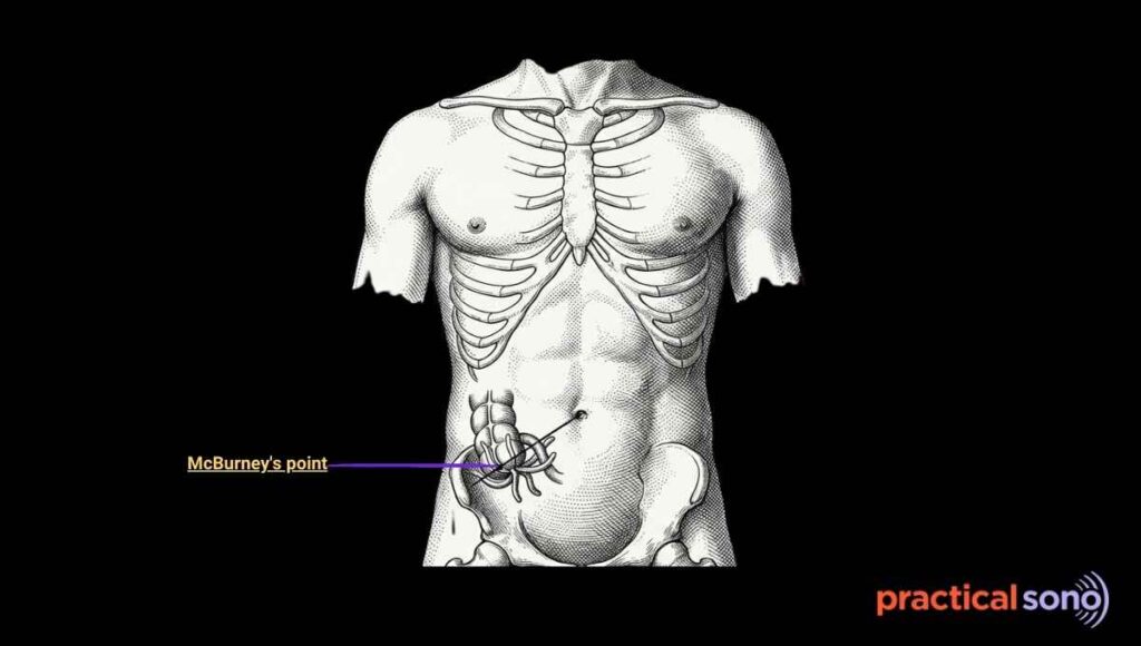 anatomy of appendix and its appearance in ultrasound 