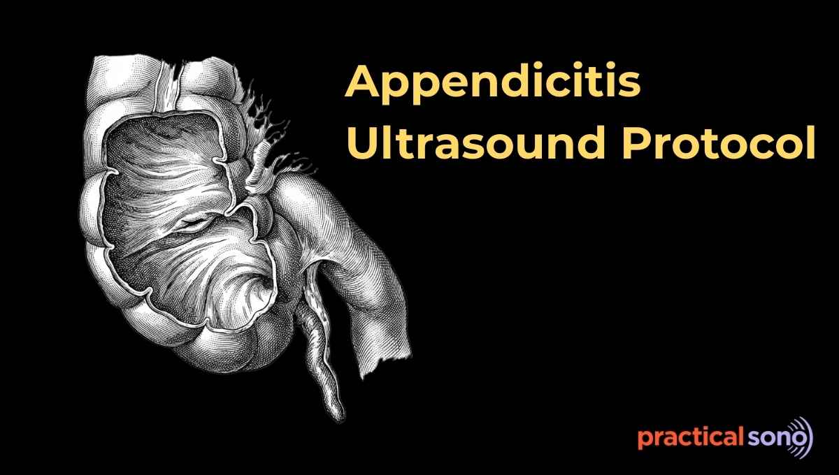 appendicitis ultrasound protocol