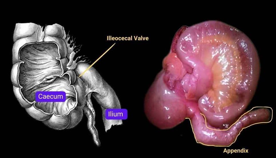 appendix origin at caecum