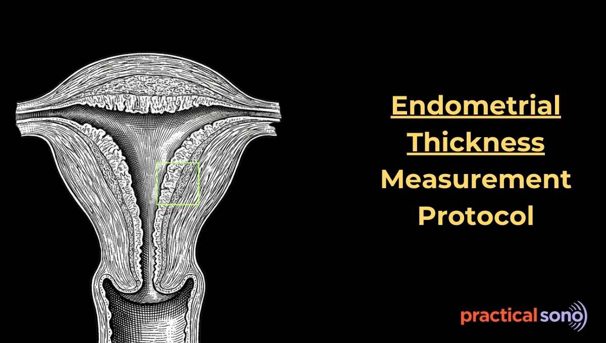 endometrial thickness measurement protocol ultrasound featured image