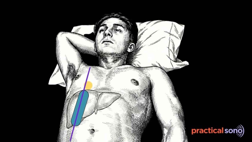 patient position while measuring liver size