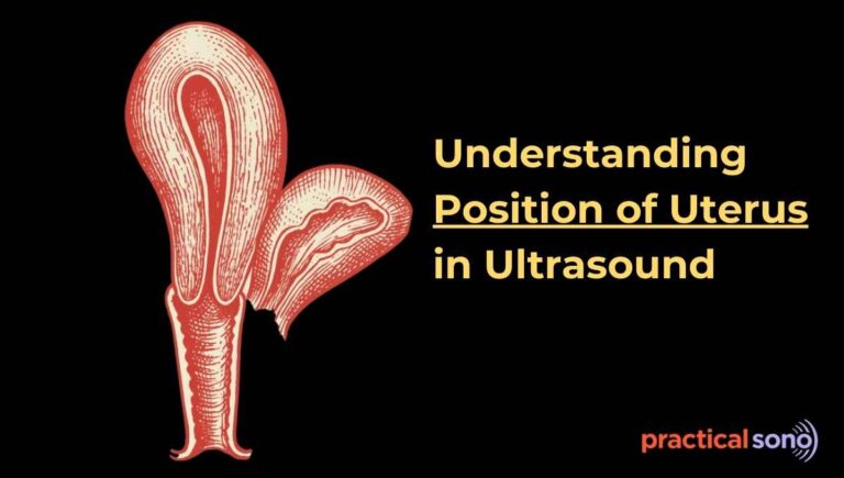 position of uterus in ultrasound featured image