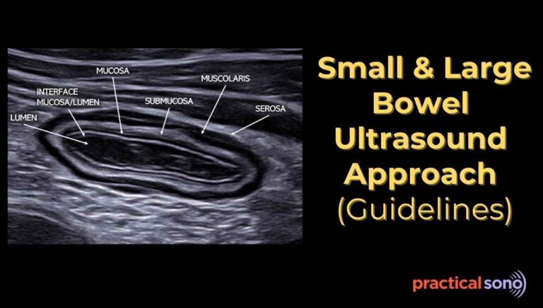 common bowel pathology Ultrasound pattern