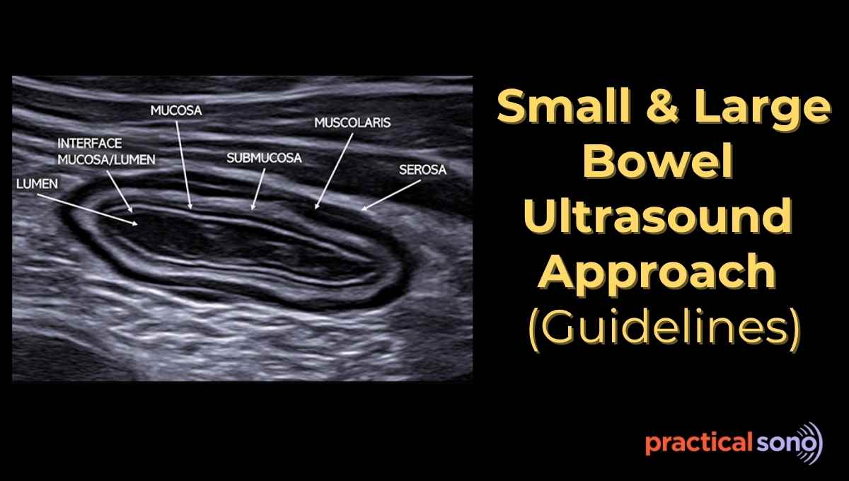 common bowel pathology Ultrasound pattern