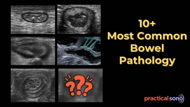 list of common bowel pathology
