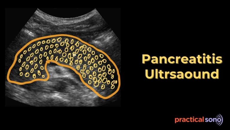 pancreatitis ultrasound